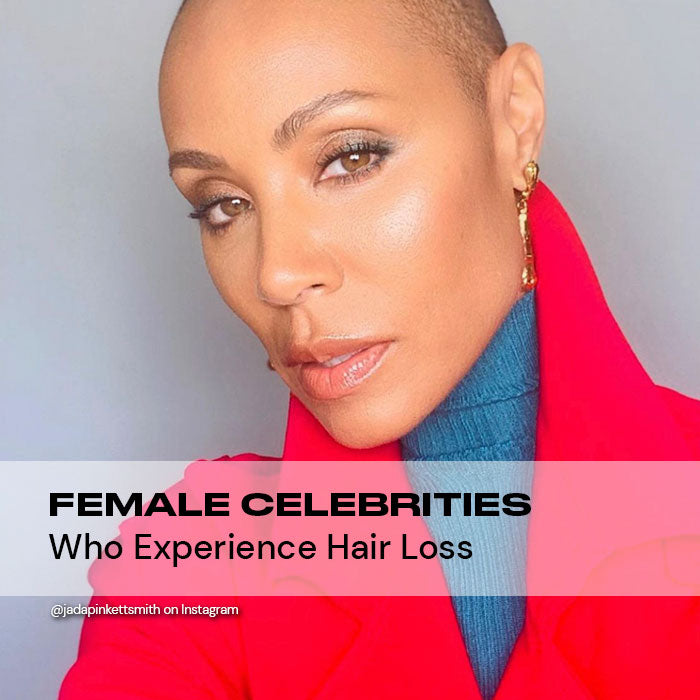 Female Celebrities Who Experience Hair Loss