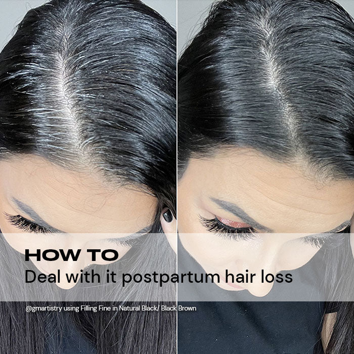 How to Deal With Postpartum Hair Loss