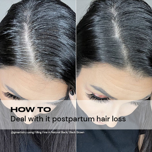How to Deal With Postpartum Hair Loss