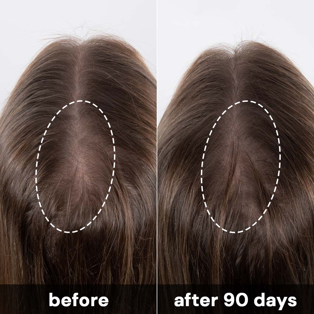 Complete Scalp System