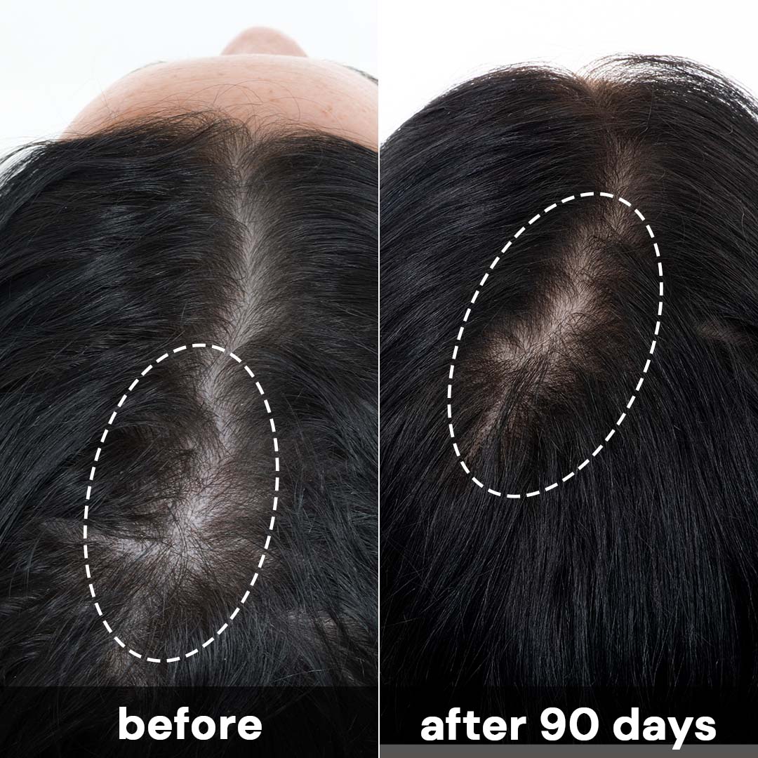 Complete Scalp System